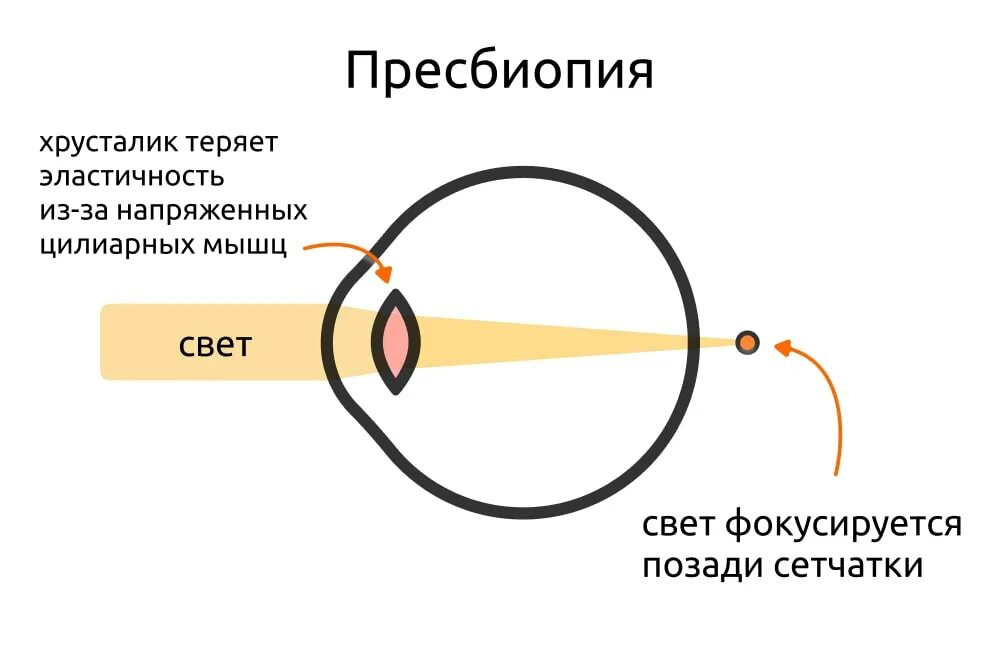 Физ око. Рефракция глаза. Клиническая рефракция глаза. Нарушение рефракции глаза. Статическая рефракция глаза.