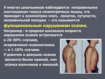 Асимметрия мышц