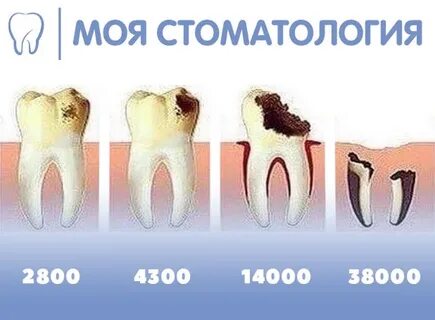 Почему зуб ноет ночью