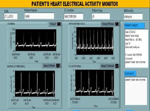 Фигуры Лиссажу LABVIEW. Фигуры Лиссажу в лабвью. LABVIEW стимулятор ЭКГ. Осциллограф лабвью. Pulse by isq unreleased