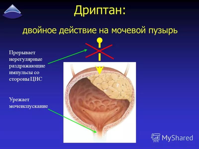 Неполное мочеиспускание. Гипоактивный и гиперактивный мочевой пузырь. Препараты от гиперактивности мочевого пузыря. Гиперактивный мочевой пузырь у женщин препараты. Гиперактивный мочевой пузырь у мужчин.