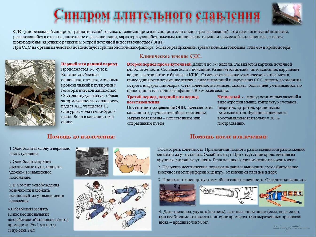 Действия при травматической ампутации. Синдром длительного раздавливания первая помощь. Синдром длительного сдавления (краш-синдром). Оказание первой помощи при краш синдроме. Синдром длительного сдавливания ПМП.