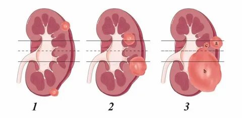 Renal почки