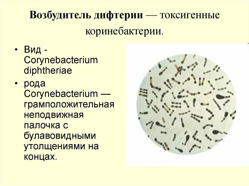 Инфекция латынь. Коринобактерия дифтерии микробиология. Дифтерийная палочка Corynebacterium diphtheriae. Коринебактерии микробиология морфология. Морфология дифтерии микробиология.