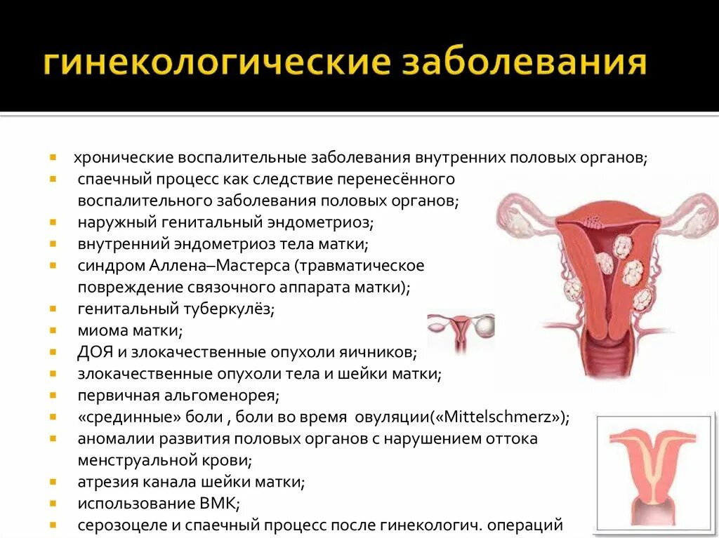 Заболевание матки у женщины симптомы