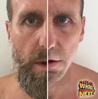 Former man