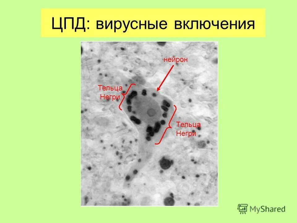 Внутриклеточные включения вирусов. Внутриклеточные включения вирусов