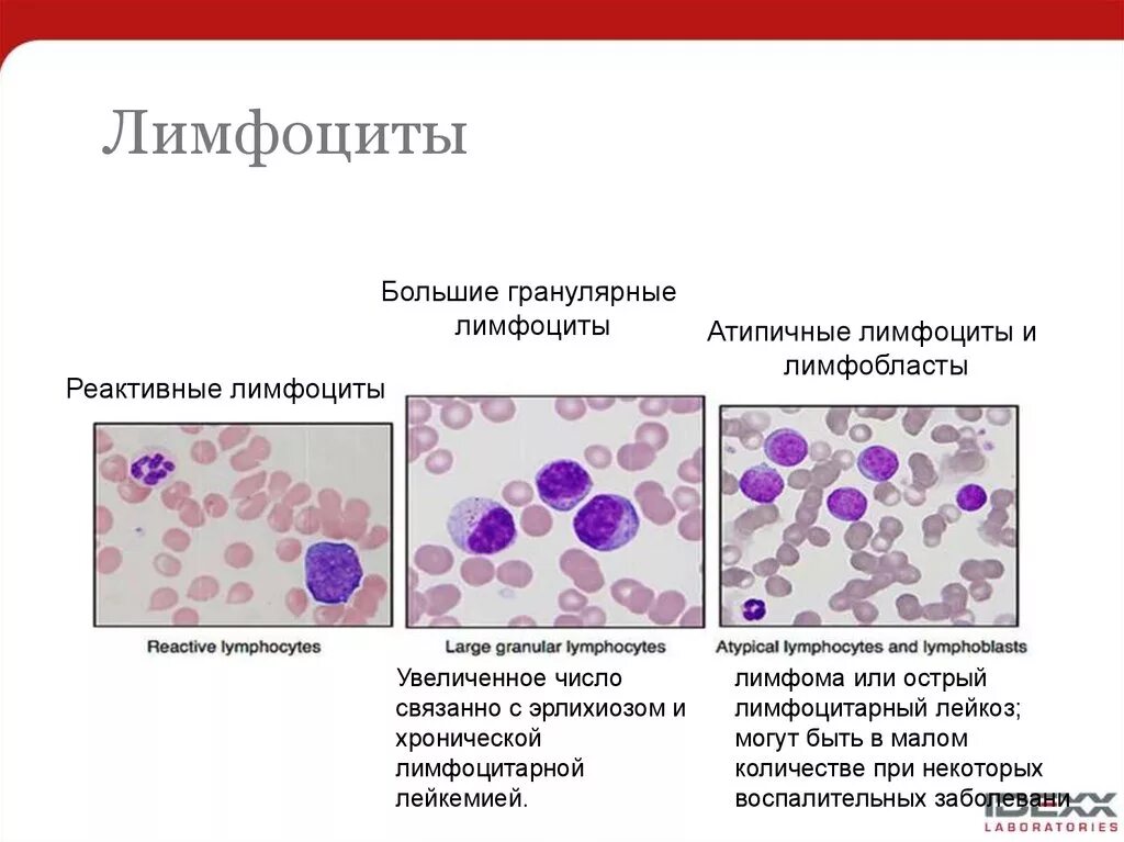 Клетки с признаками реактивных изменений