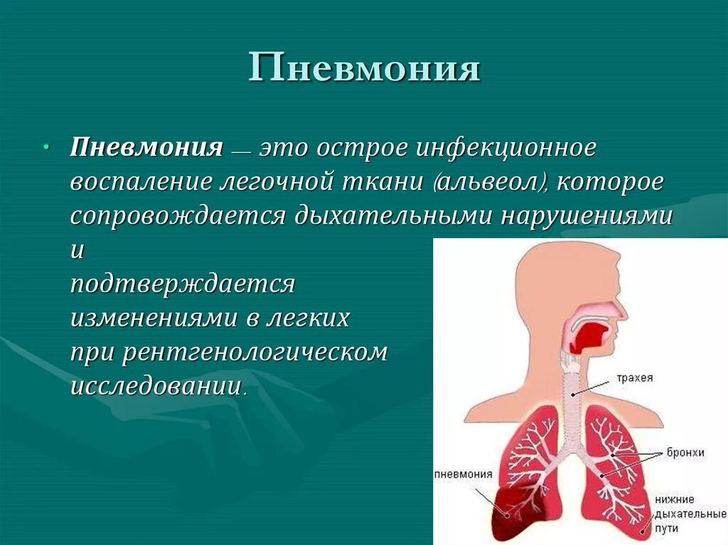 Инфекция легких лечение