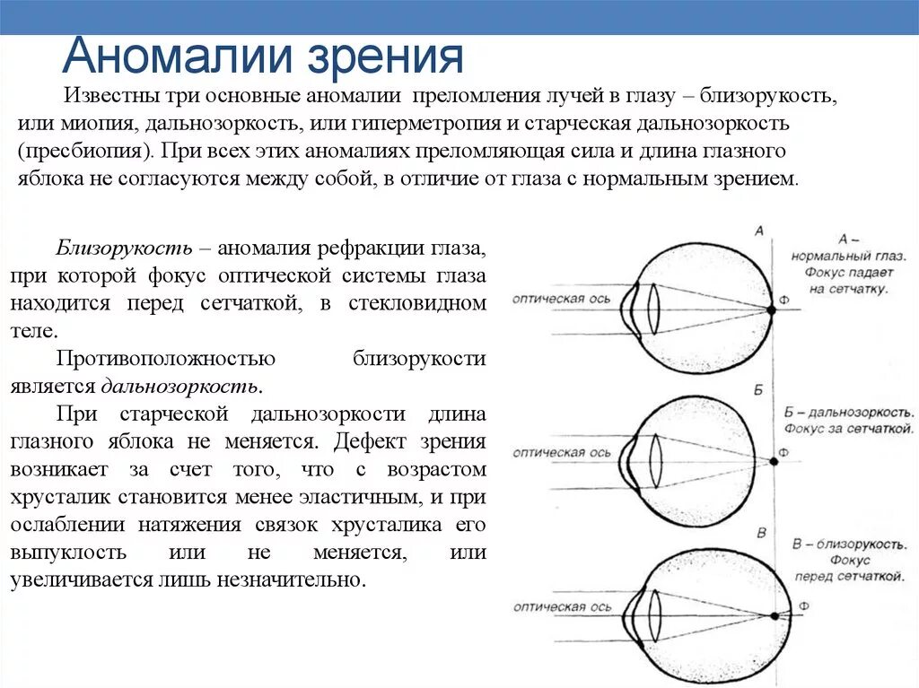 Зрительные аномалии