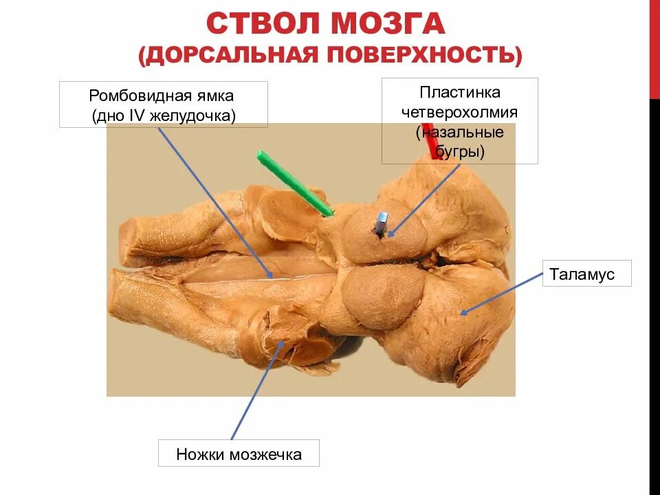 Дорсальная поверхность мозга. Ствол мозга и промежуточный мозг. Ствол мозга зрительные Бугры. Ствол мозга препарат анатомия. Вентральная поверхность ствола головного мозга.