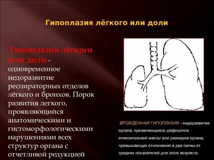 Порок легких