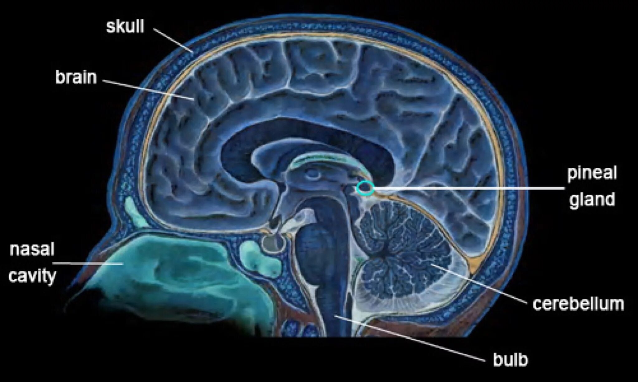 Пинеальная железа это. Шишковидная железа головного мозга. Ретроцеребеллярная киста шишковидной железы. Киста шишковидной железы мрт. Шишковидное тело в головном мозге.