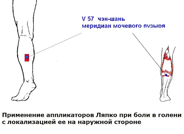 Почему болит кость ноги спереди. Болит кость голени сбоку. Болит голень сбоку с внешней стороны. Боль в голени сбоку с внешней стороны.