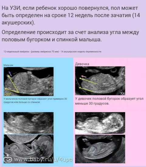 Ошибка узи. Ошибка узи