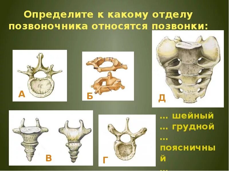 Определите отделы позвоночника. Позвонок анатомия. Шейный грудной и поясничный позвонки. Крестцовый отдел позвоночника анатомия. Общий план строения позвонков.