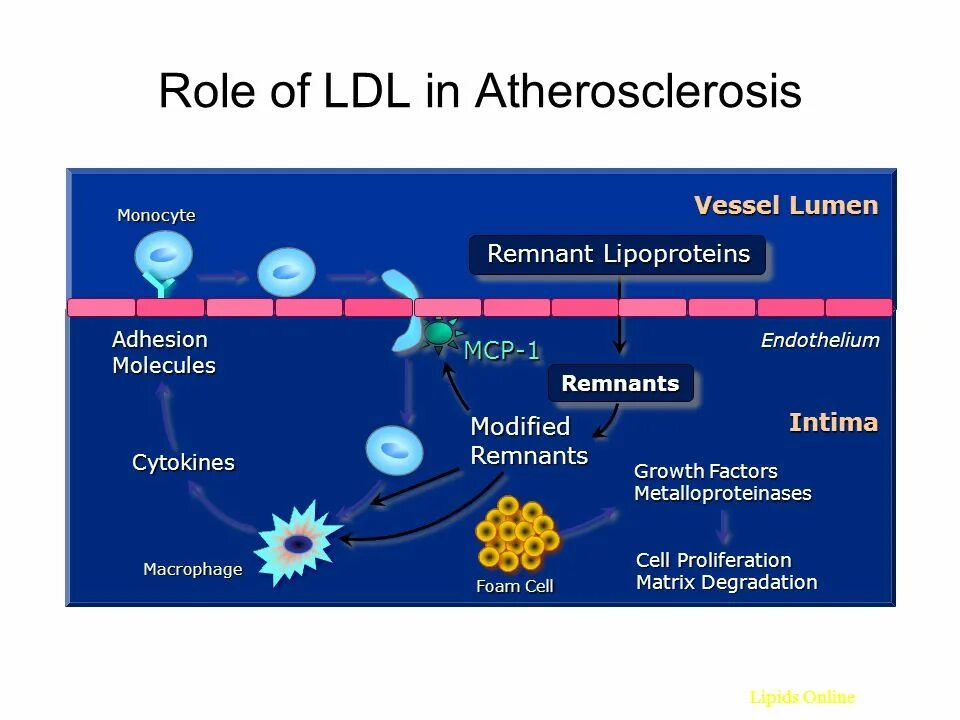 LDL. Vessel Lumen. Foam Cells. Monocyte metabolism.