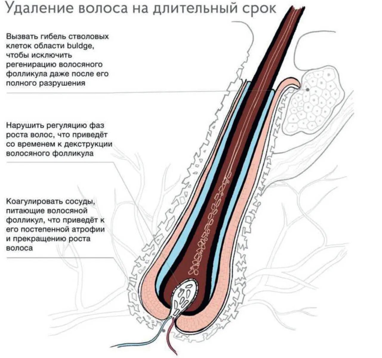 Строение волоса лазерная эпиляция. Структура волос электроэпиляция. Стадии роста волос лазерная эпиляция. Стадии роста волос. Рост волоса происходит за счет