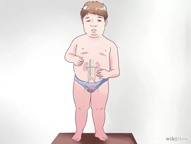Отеки при гломерулонефрите