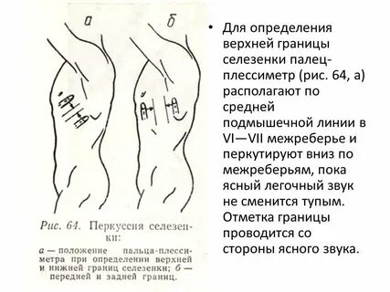 Перкуссия селезенки