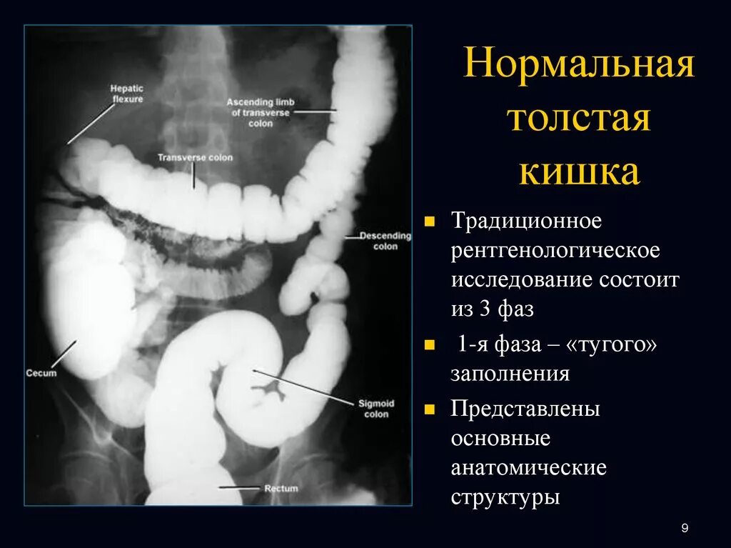 Нормальный пищевод. Ультрасонография Толстого кишечника. Рентгенологическое исследование толстой кишки.