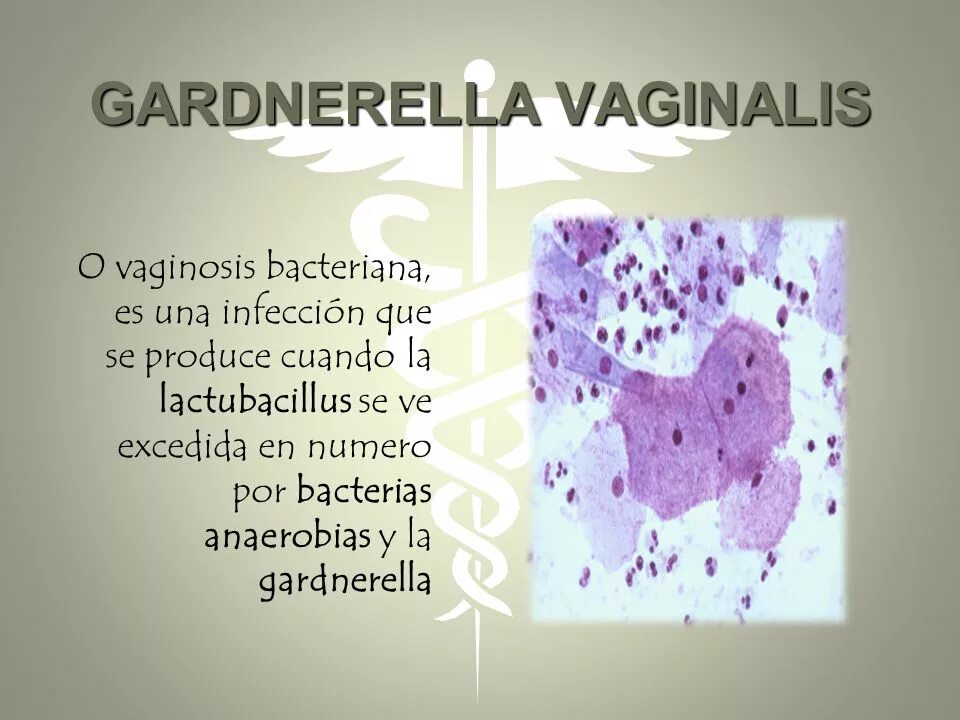 Мобилункус гарднереллы. Обнаружена gardnerella vaginālis. Бактериальный вагиноз микроскопия мазка. Обнаружена gardnerella vaginālis. Гарднерелла морфология.