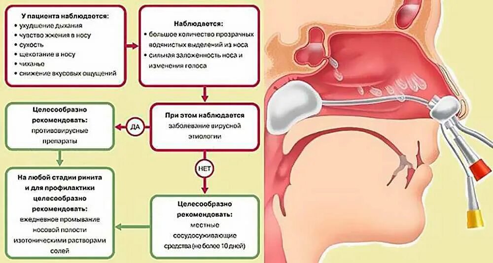 Почему носом без соплей