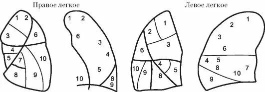 10 сегментов легких. Сегментарное строение легких боковая проекция. Сегментарное строение легких анатомия. Доли и сегменты легких в боковой проекции. Доли и сегменты легких в прямой и боковой проекции.