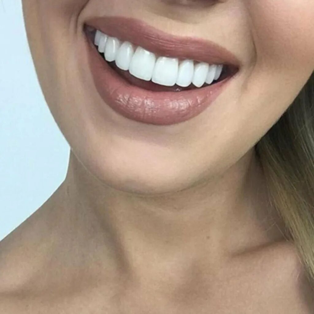 ровные белые зубы. универсальные виниры perfect smile veneers. красивые ровные зубы. голливудская улыбка виниры. паста дента сеал.