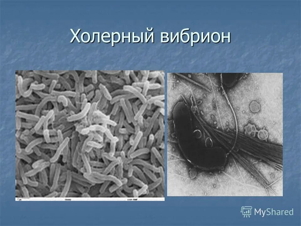 холерный вибрион паразит человека