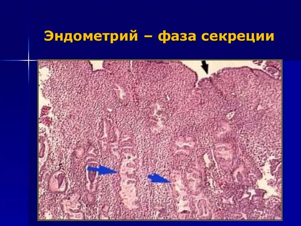 Пролиферация эндометрия гистология. Ранняя фаза секреции эндометрия гистология. Пролиферативная фаза эндометрия. Эндометрий матки гистология пролиферативная фаза. Эндометрия ранней секреции