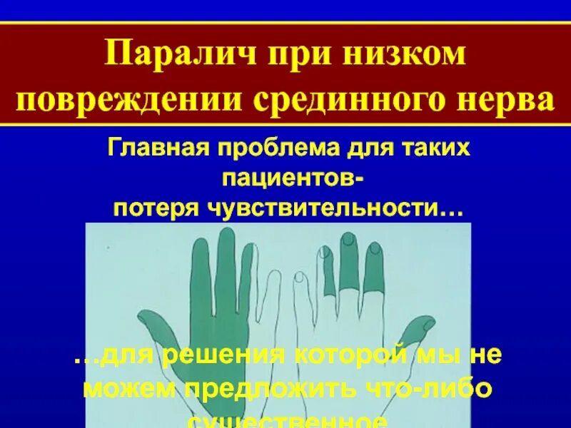 Потеря чувствительности 8. Виды потери чувствительности. Снижение тактильной чувствительности. Болевой чувствительности лишена:. Классификация анестезии.
