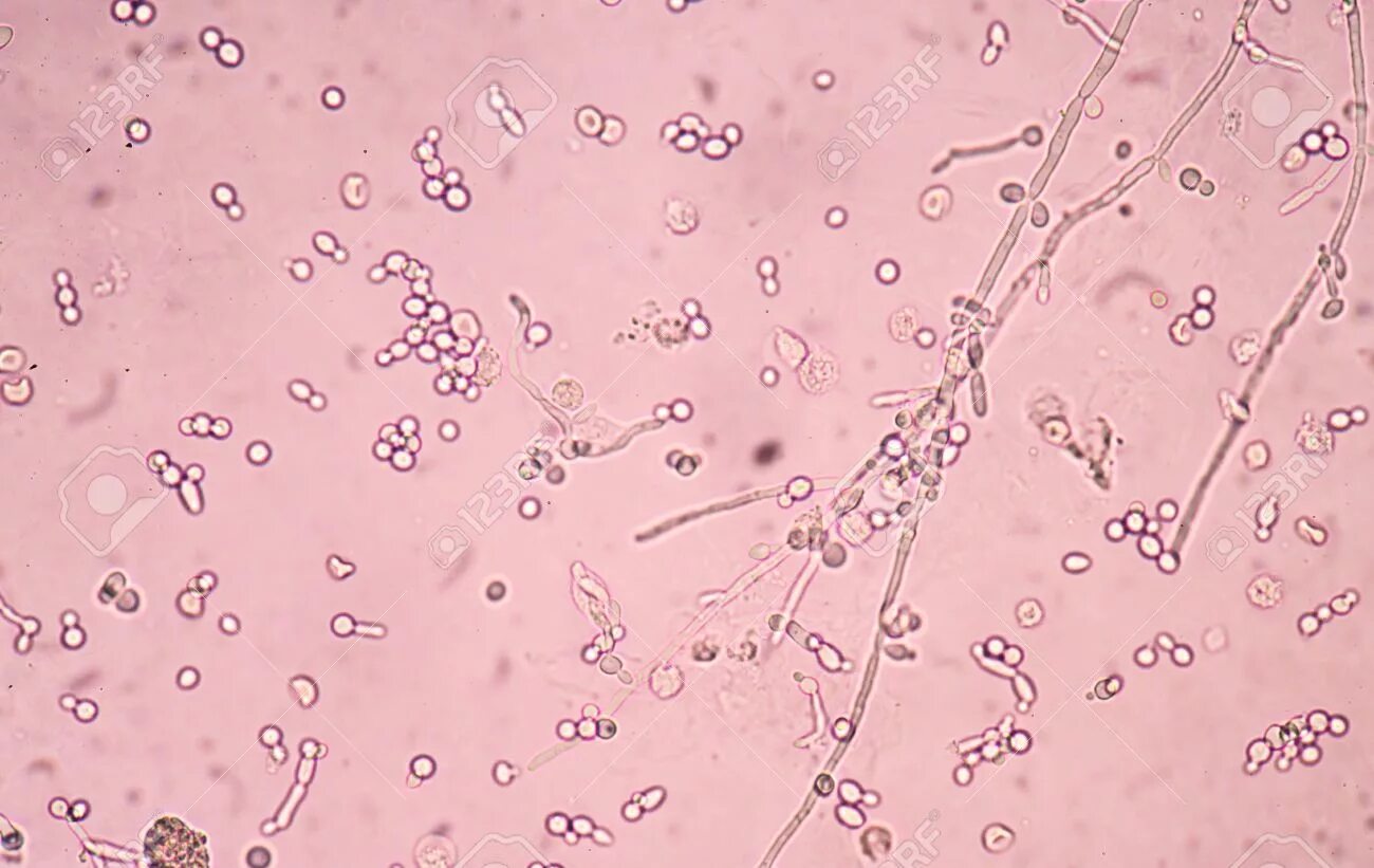 Дрожжевые клетки в моче повышены. Candida дрожжевые клетки псевдомицелий. Грибы кандида микроскопия. Candida albicans почкующиеся клетки. Кандида бактерия под микроскопом.