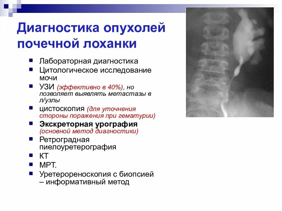 Диагностический метод при подозрении на опухоль почки. Наиболее достоверный метод диагностики опухоли почек. Злокачественное новообразование почки.