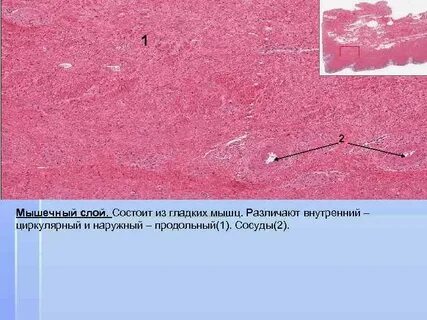 Хорошо развит мышечный слой