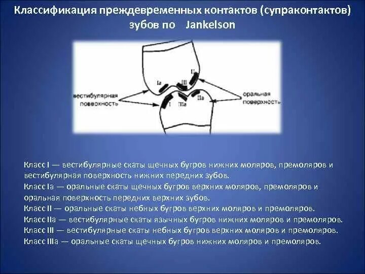 Скат бугорка
