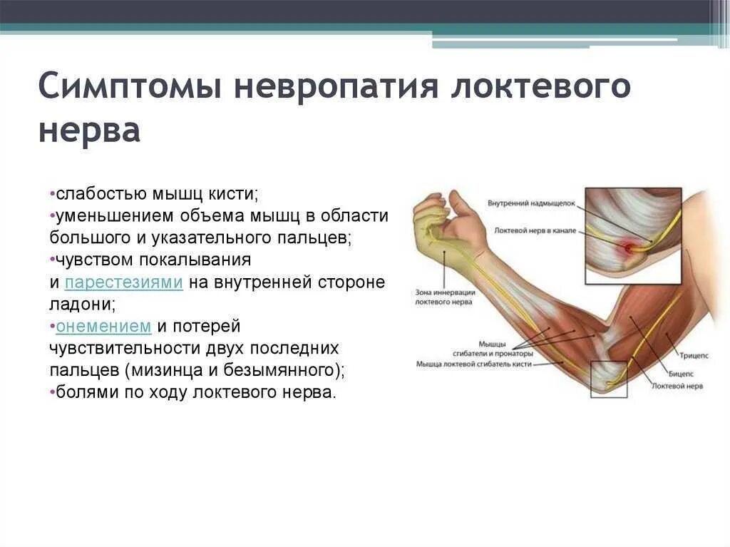 Слабость верхних конечностей