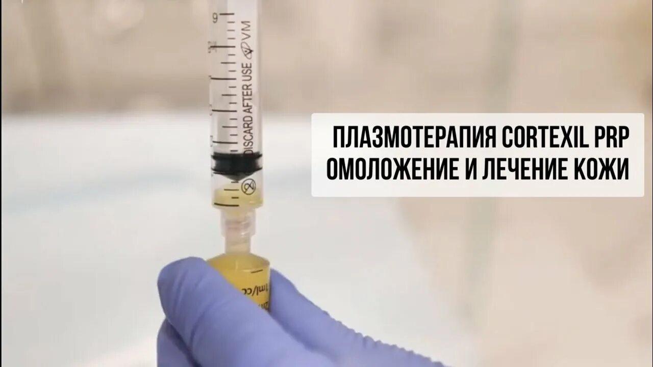 Плазмолифтинг cortexil. Cortexil prp плазмотерапия. пробирки cortexil prp. процедура cortexil prp что это. cortexil prp плазмотерапия лица.