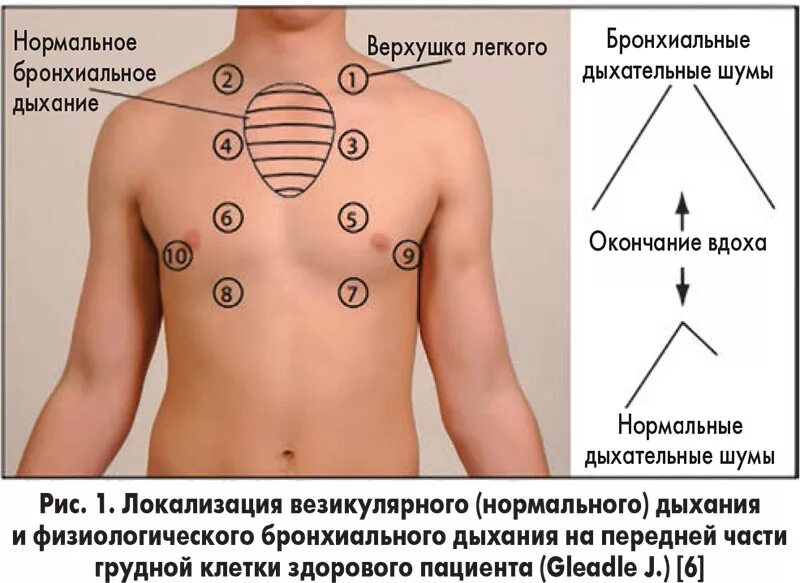 Аускультация грудной клетки алгоритм. Точки аускультации легких у детей. Аускультация легких пропедевтика. Аускультация грудной клетки. Аускультация легких алгоритм точки.