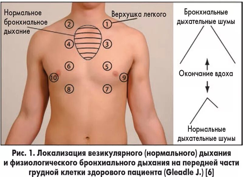 Аускультация легких точки выслушивания. Аускультация легких алгоритм точки. Схема выслушивания легких. Точки проведения аускультации лёгких. Шум от движения легкого