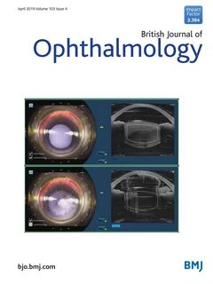 Ophthalmology journal