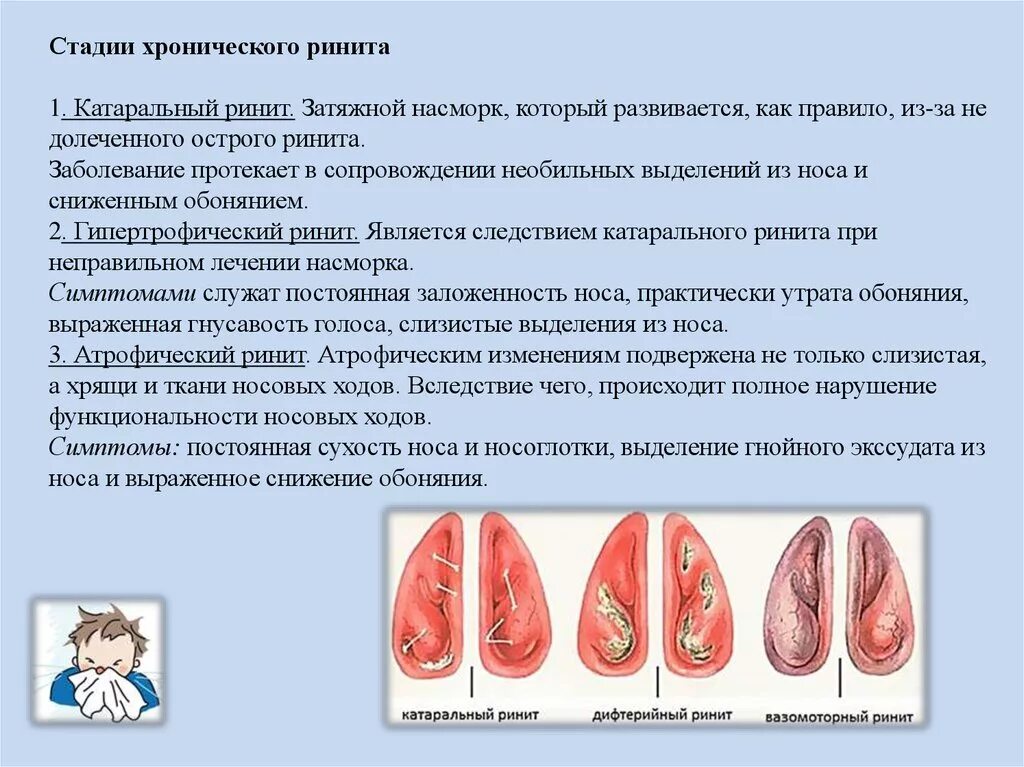 Хронический катаральный ринит этиология. Хронический гипертрофический ринит стадии. Гипертрофический ринит слизистая. Острый катаральный ринит