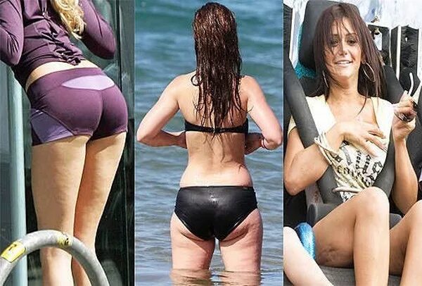 Леди гага целлюлит. Мишель хунцикер в купальнике. Целлюлит у худых девушек. Целлюлит у худых девушек. Целлюлит у худых девушек.