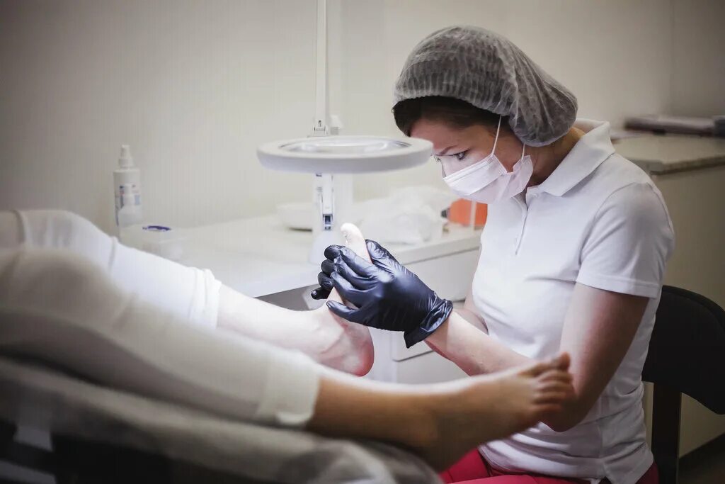 дроздов антон олегович. подологический центр. подолог чебоксары. резекция вросшего ногтя. резекция вросшего ногтя лазером.