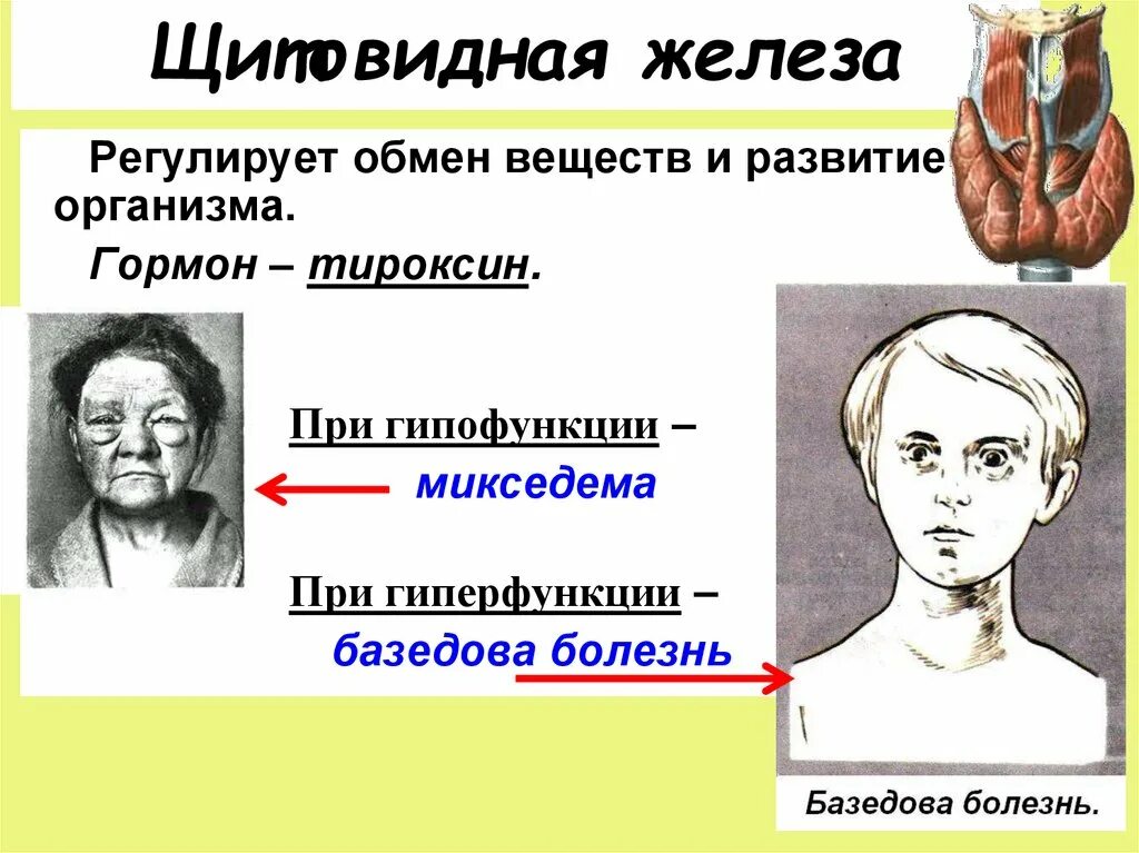 Заболевание при недостатке тироксина. Болезни щитовидной железы ЕГЭ биология. Гормоны щитовидной и паращитовидной желез. Болезни щитовидной железы ЕГЭ. Щитовидная железа гормоны гиперфункция и гипофункция.