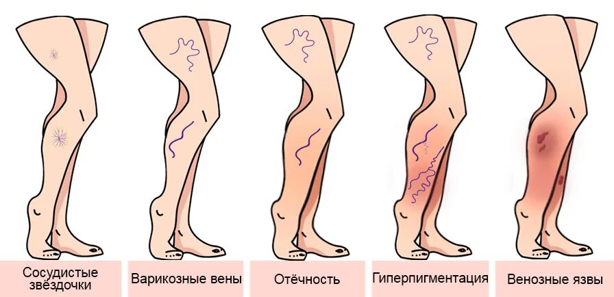 Pin on Disease