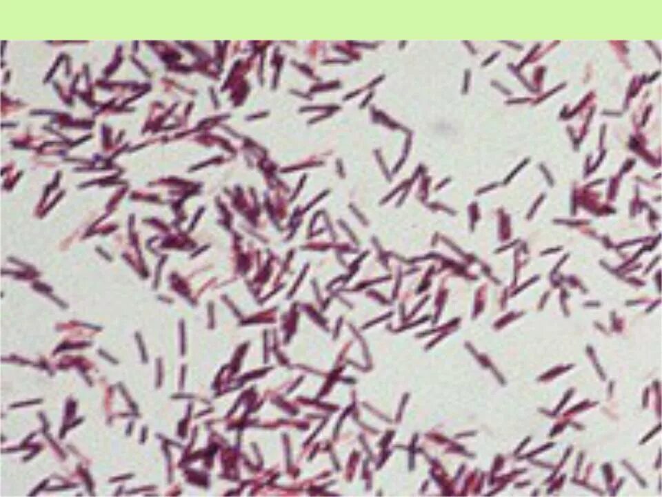 Bacillus Cereus Ожешко. Бациллы цереус Bacillus Cereus. Bacillus Cereus микроскоп. Бациллюс цереус микробиология. Ботулизм сальмонеллез