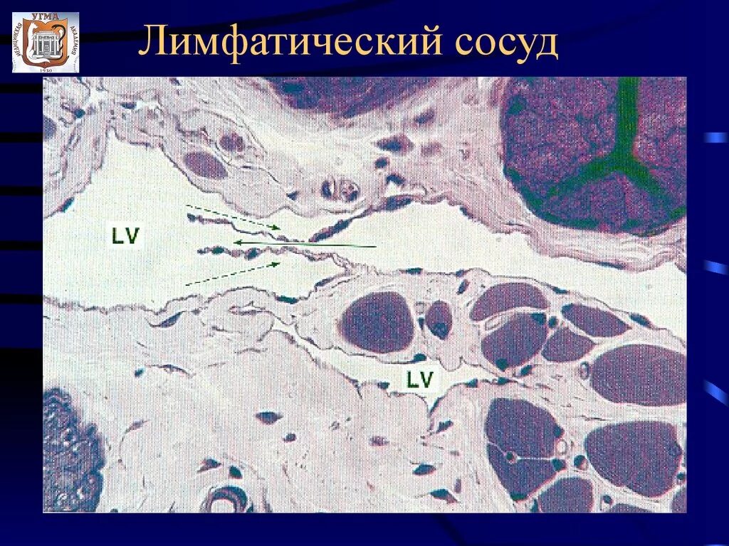 Лимфотмческие "посуды гичтологи_. Строение лимфатических сосудов гистология. Лимфатические сосуды гистология. Стенка лимфатического сосуда