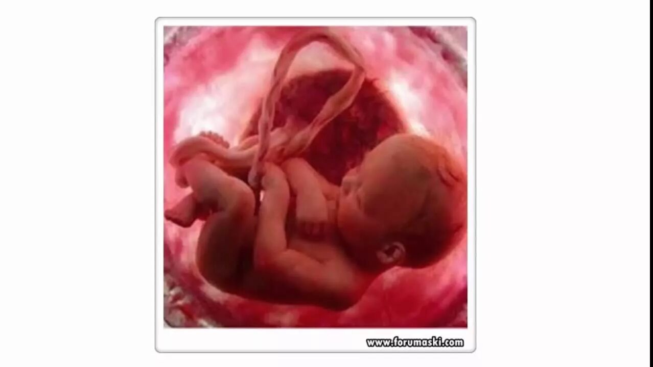 Pin on baby developments