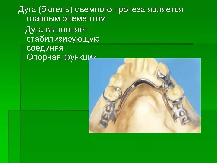 Планирование конструкции бюгельного протеза. Расположение дуги бюгельного протеза на верхней челюсти. ширина дуги бюгельного протеза на нижней челюсти. дуга бюгельного протеза. расположение дуги бюгельного протеза.